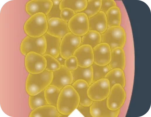 Fat_Cells_Closeup_1_Desktop