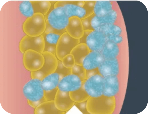 Fat_Cells_Closeup_2_Desktop_259x200