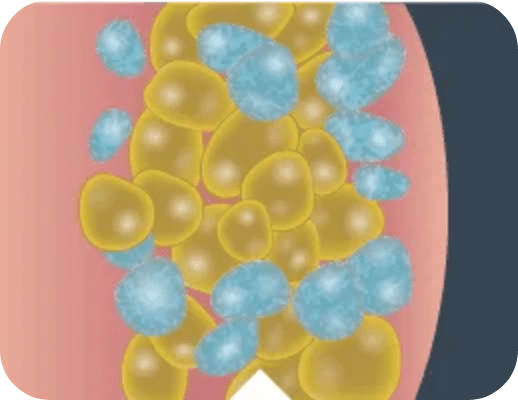 Fat_Cells_Closeup_3_Desktop_259x200