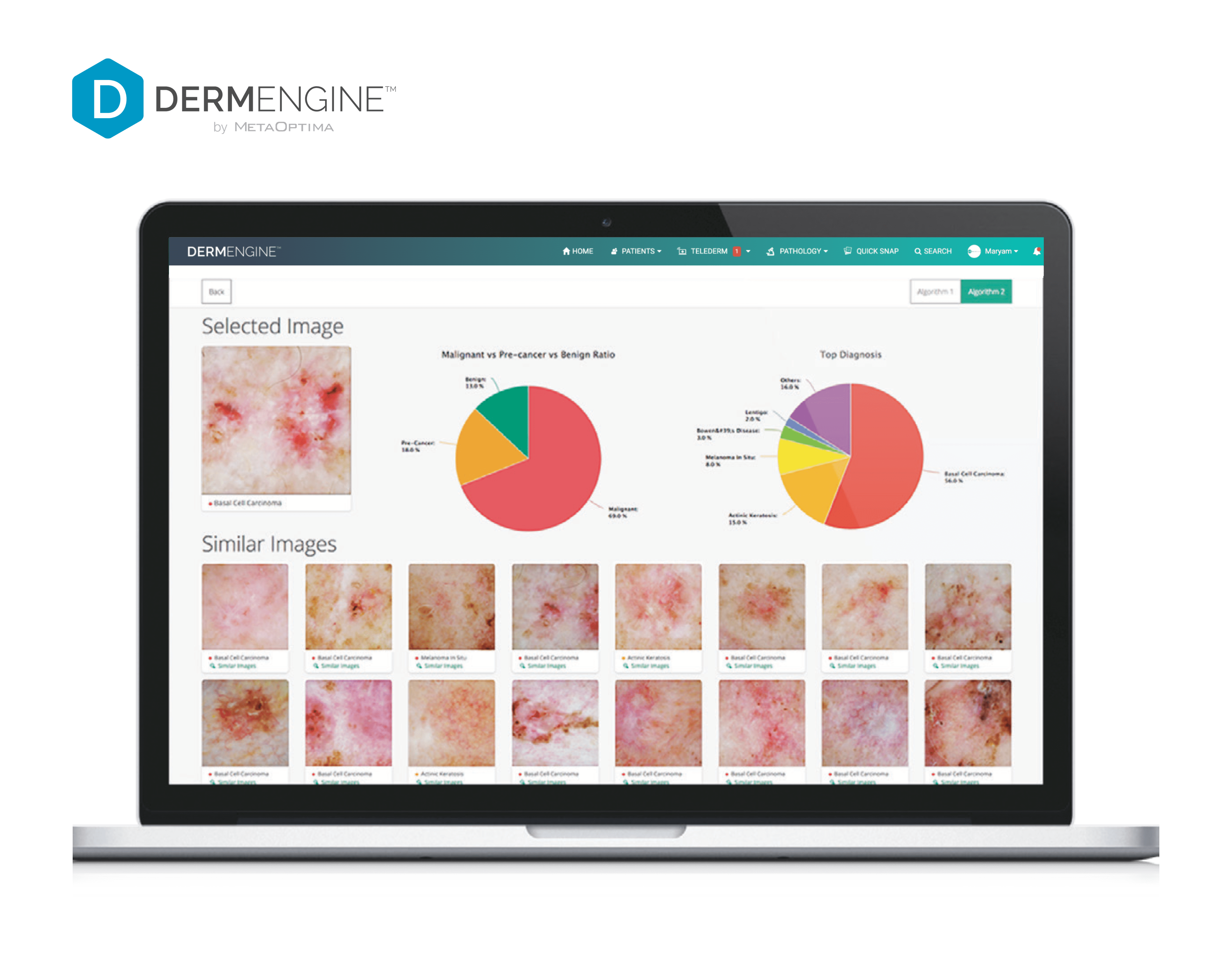 VisualSearch VisualSearch